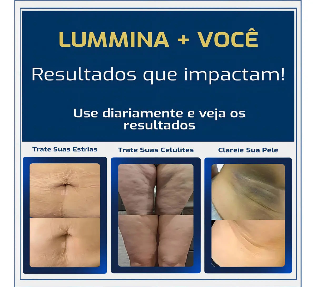 Lummina Creme para Estrias (200g)